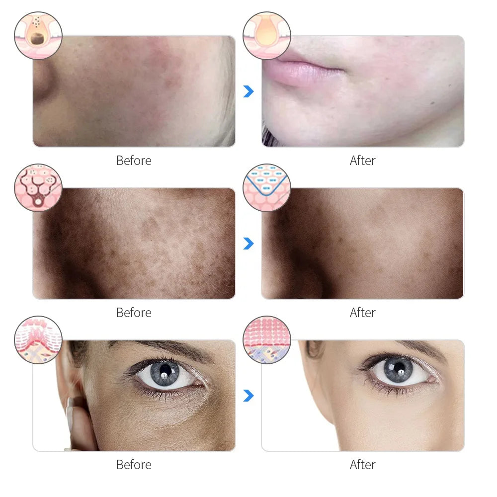 Luxesaura™ Wireless LED Light Therapy Mask