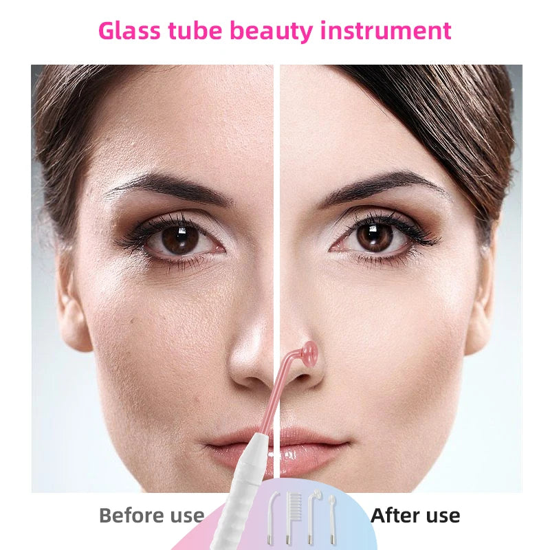 Luxesaura™ High Frequency Facial Machine Electrotherapy