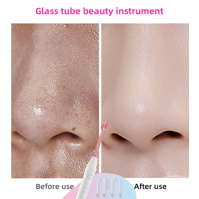 Luxesaura™ High Frequency Facial Machine Electrotherapy